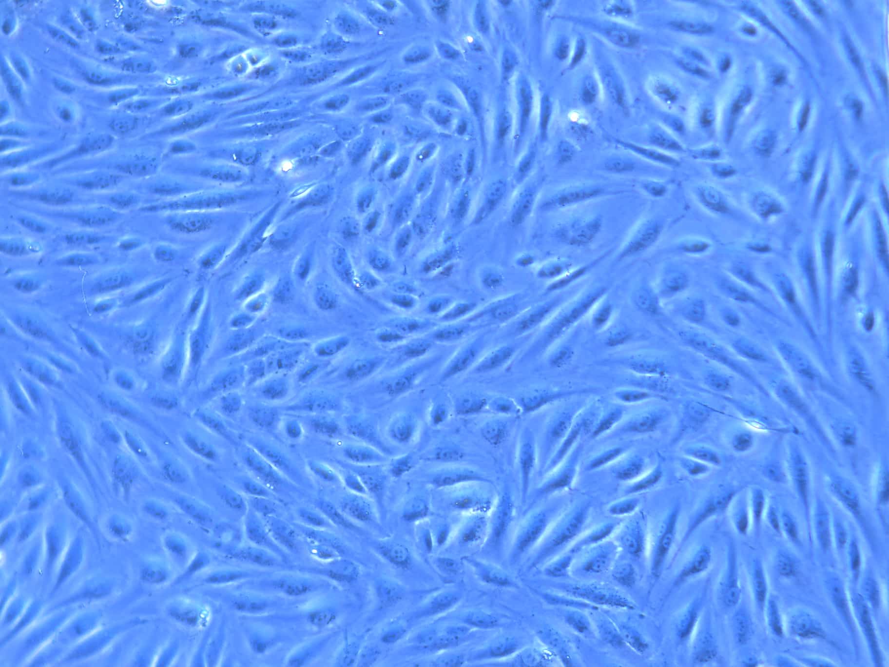 Huvec cells after omi