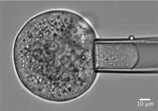 micropipette-cell-aspiration-fluigent